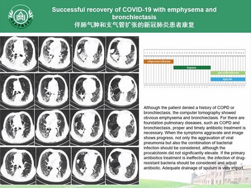 微信圖片_20200616153415.jpg 微信圖片_20200616153415.jpg