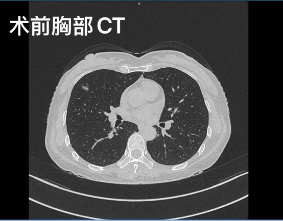 from clipboard from clipboard